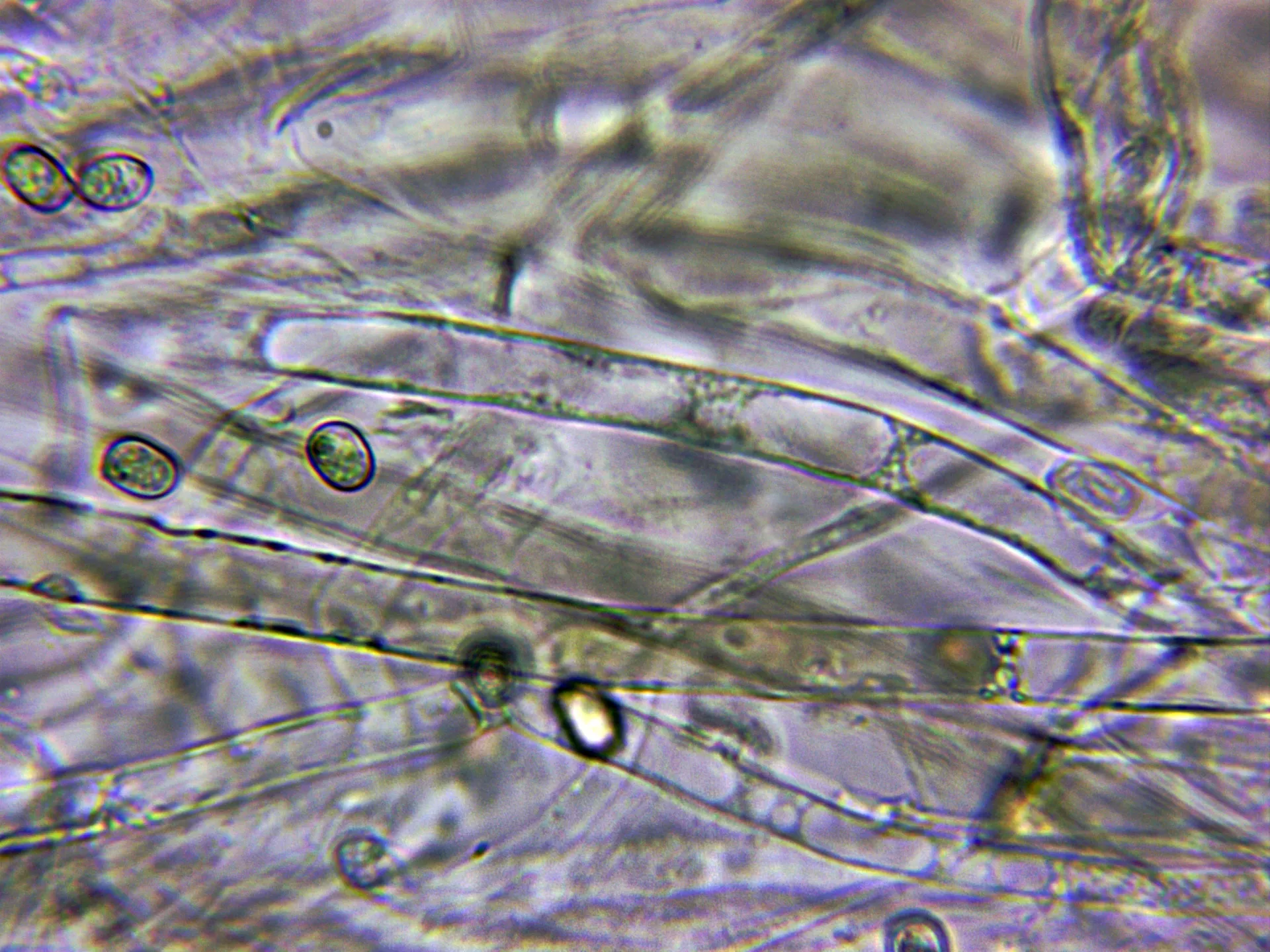 Microscopía de Pluteus pouzarianus - 10 - Hifas cutícula